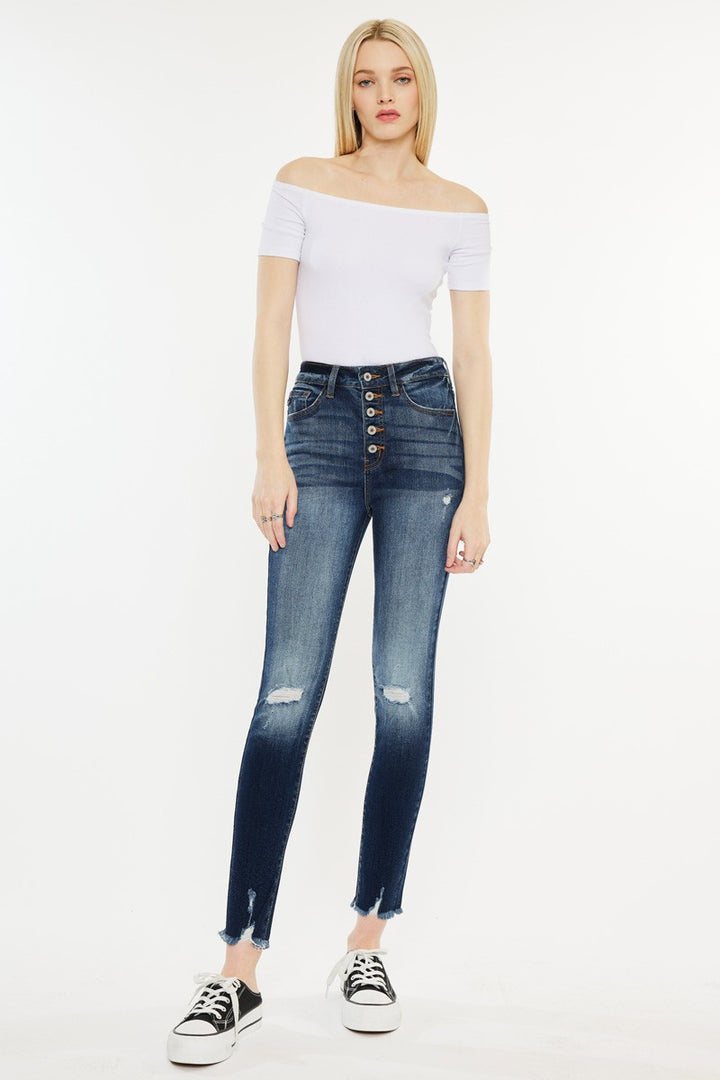 Melissa Skinny Jeans