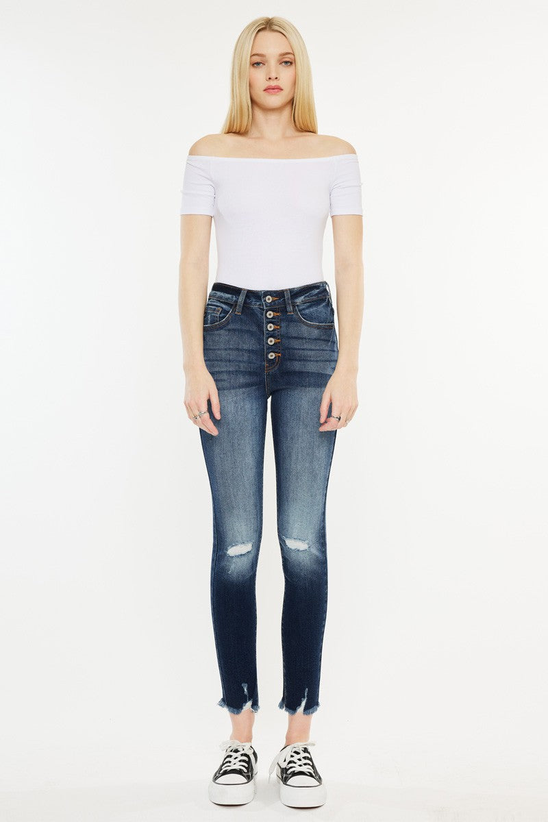 Melissa Skinny Jeans