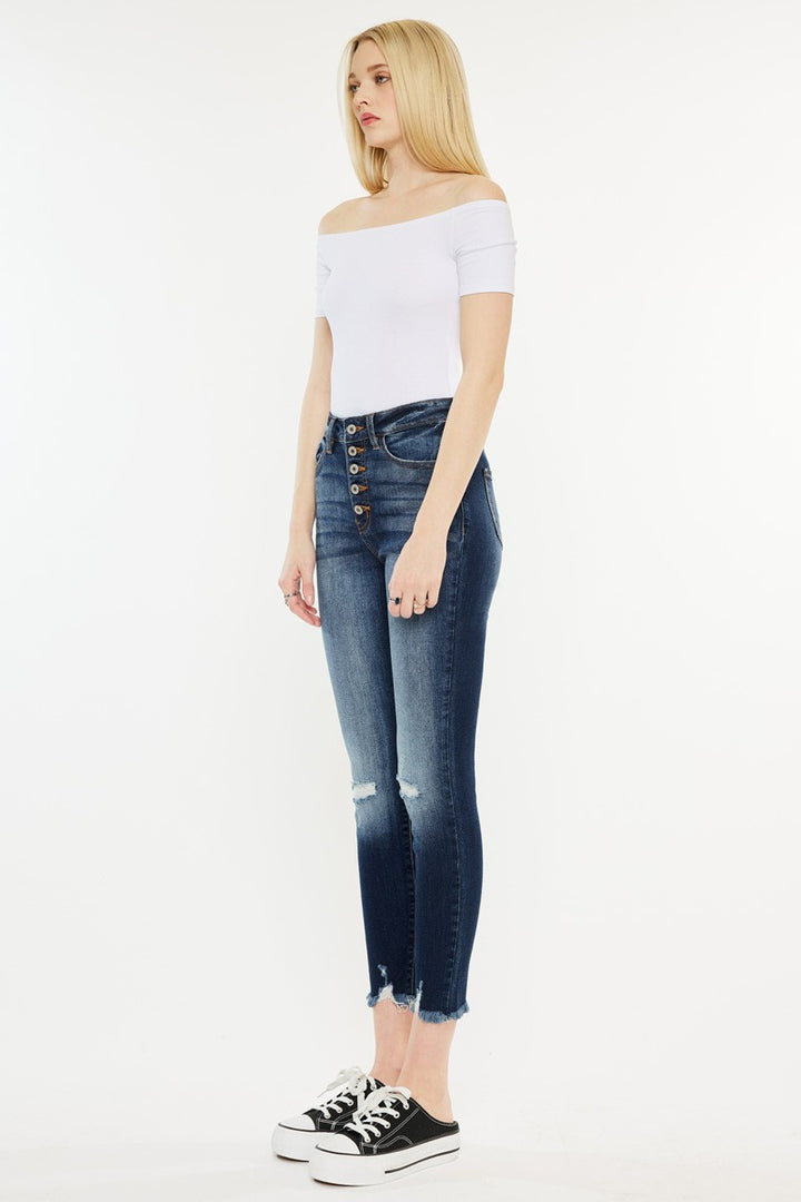 Melissa Skinny Jeans