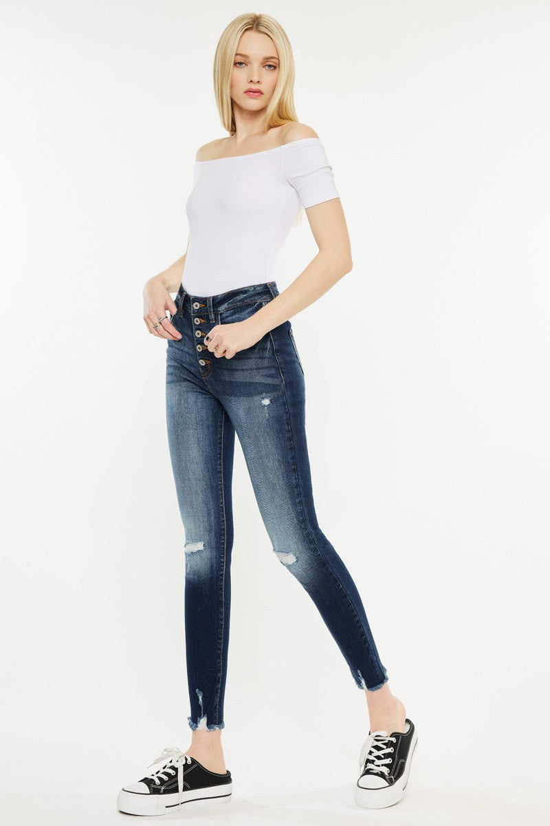 Melissa Skinny Jeans