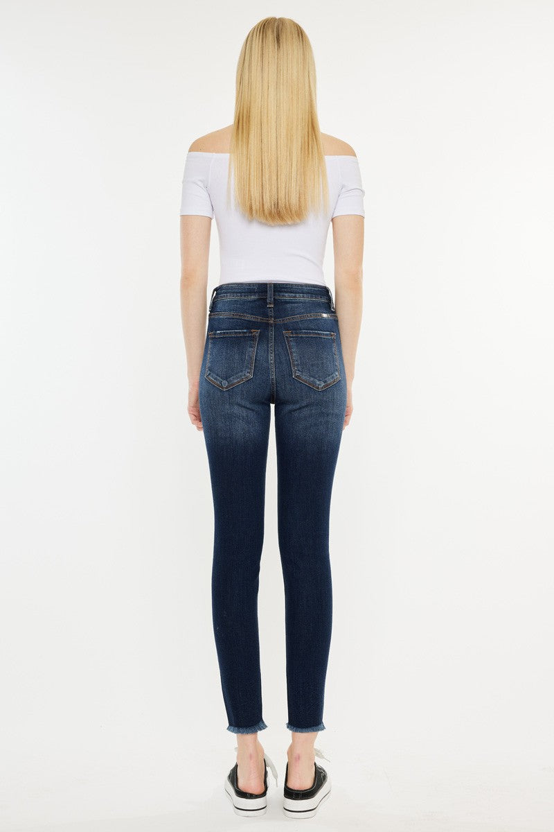 Melissa Skinny Jeans