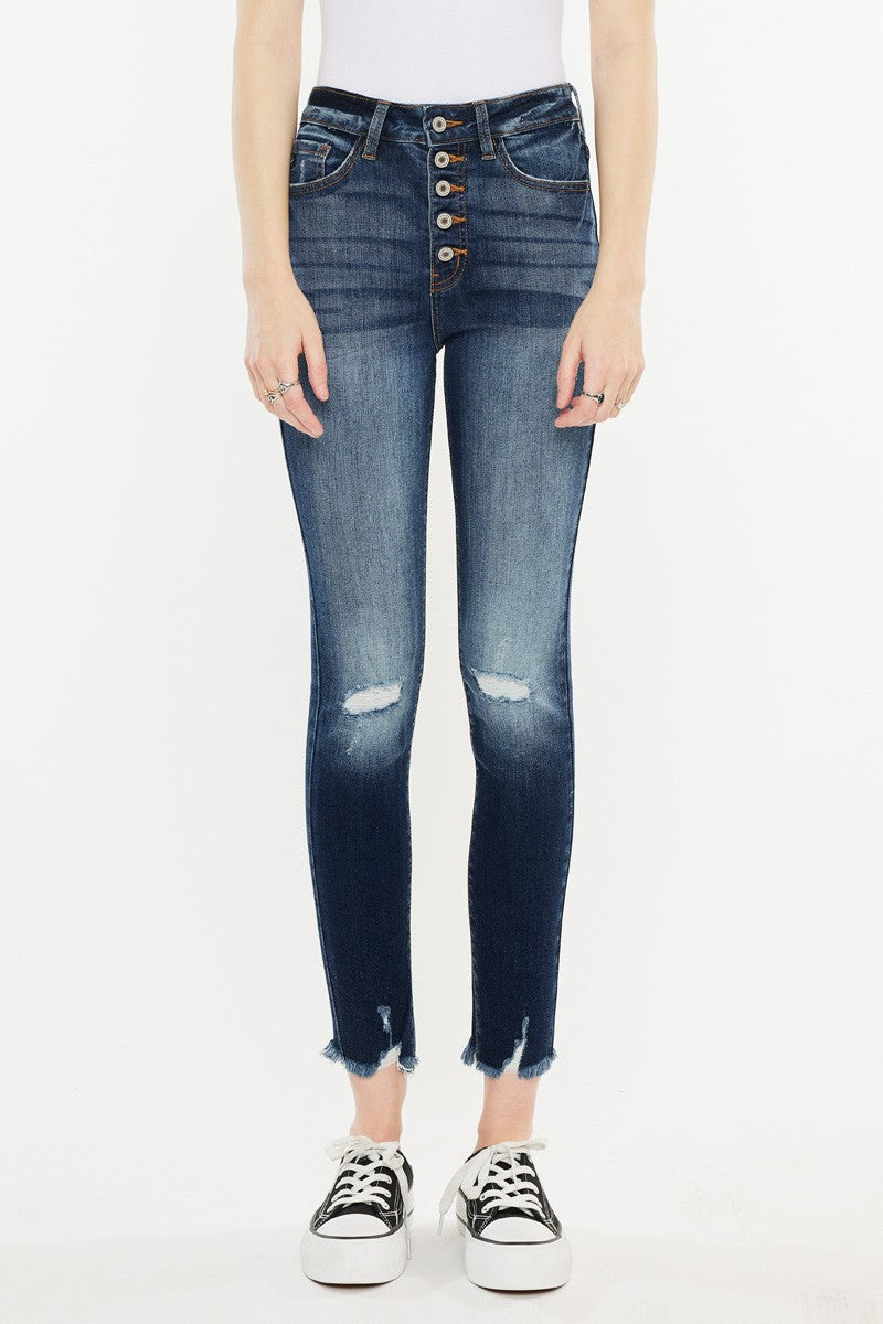 Melissa Skinny Jeans