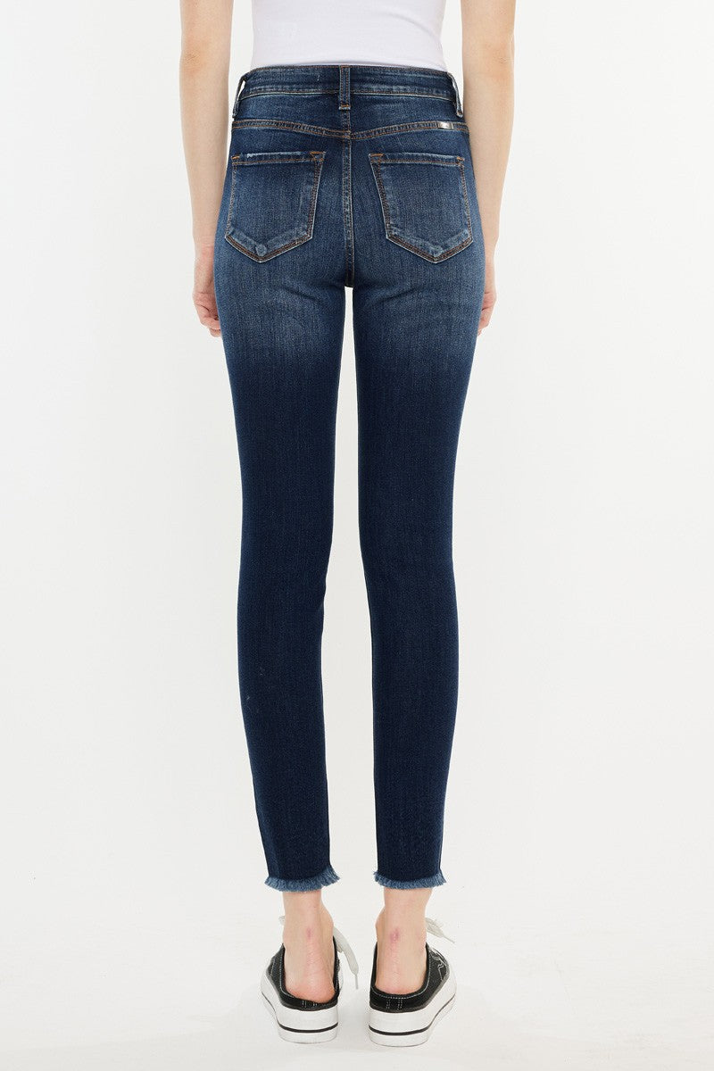 Melissa Skinny Jeans